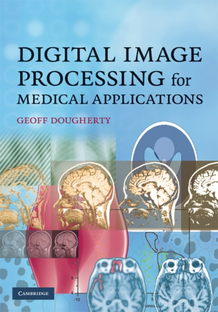 E-Book Digital Image Processing for Medical Applications Geoff Dougherty