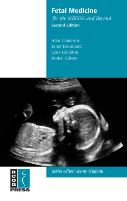 E-kniha Fetal Medicine for the MRCOG and Beyond Alan Cameron