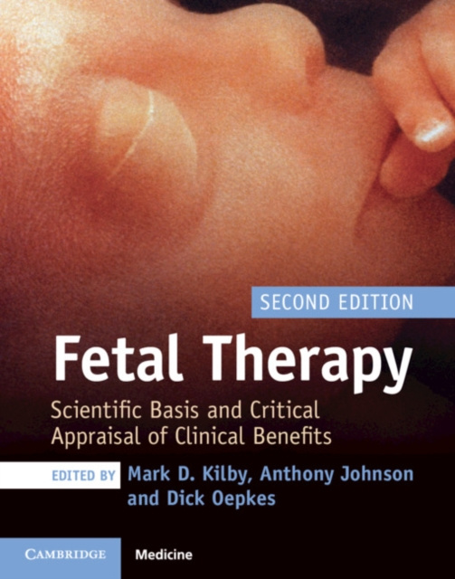 E-kniha Fetal Therapy Mark D. Kilby