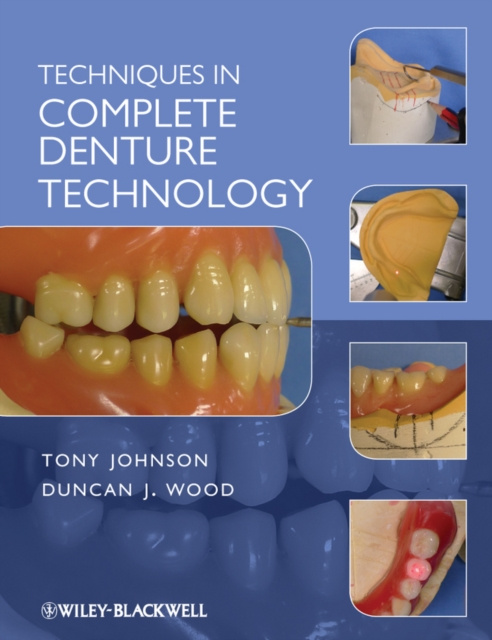 E-kniha Techniques in Complete Denture Technology Tony Johnson