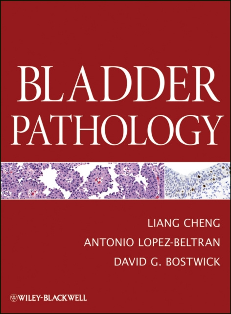 E-knjiga Bladder Pathology David G. Bostwick