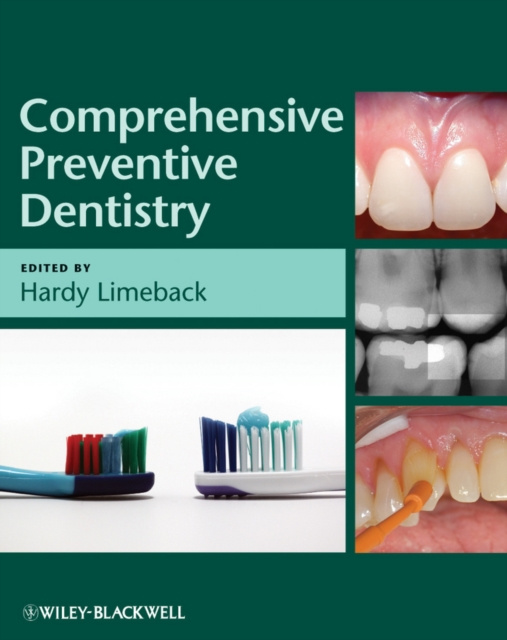 E-kniha Comprehensive Preventive Dentistry Hardy Limeback