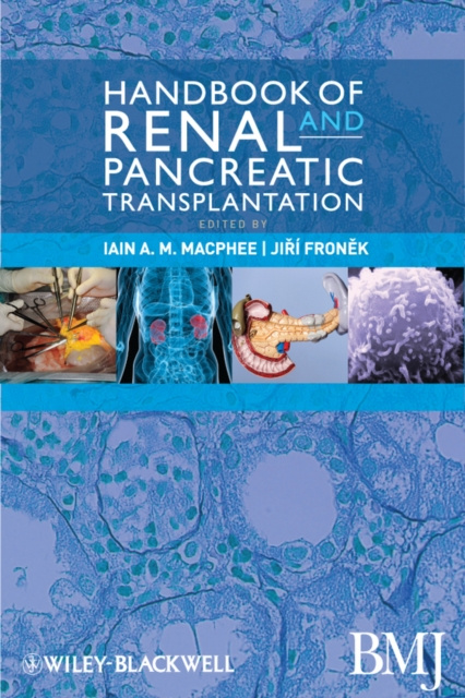 E-kniha Handbook of Renal and Pancreatic Transplantation Iain MacPhee