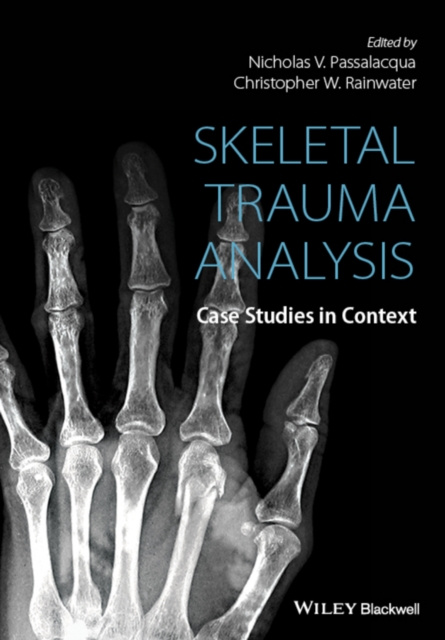 E-kniha Skeletal Trauma Analysis Christopher W. Rainwater