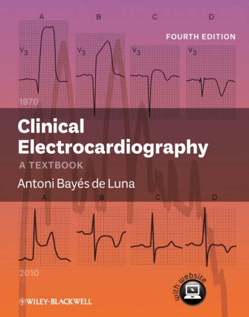E-kniha Clinical Electrocardiography Antoni Bay&eacute;s de Luna