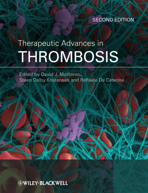 E-kniha Therapeutic Advances in Thrombosis David J. Moliterno