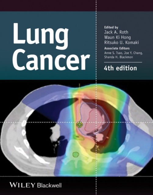 E-book Lung Cancer Jack A. Roth