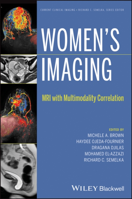 E-kniha Women's Imaging Michele A. Brown