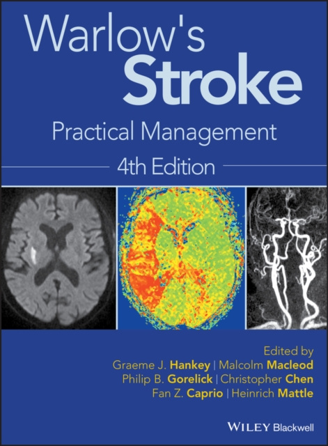 E-book Warlow's Stroke Malcolm Macleod