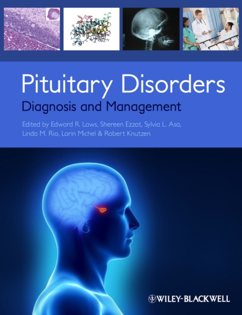 E-kniha Pituitary Disorders Edward R. Laws