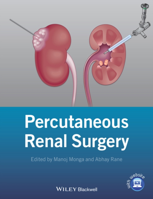 E-kniha Percutaneous Renal Surgery Manoj Monga