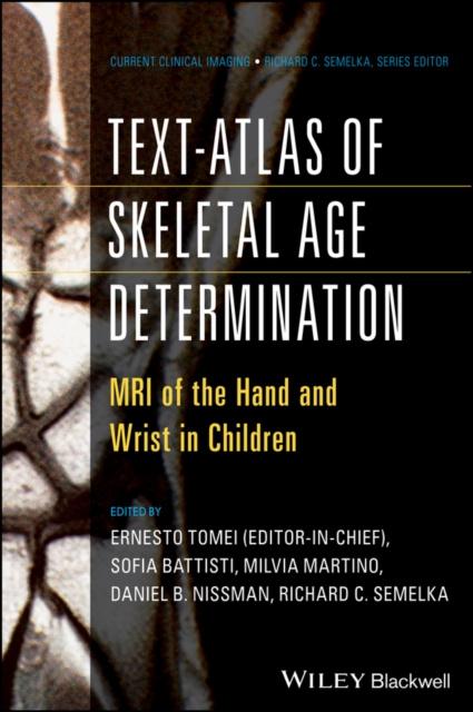 E-kniha Text-Atlas of Skeletal Age Determination Ernesto Tomei