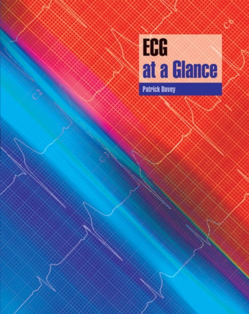E-knjiga ECG at a Glance Patrick Davey