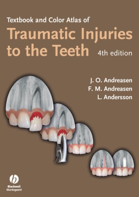 E-kniha Textbook and Color Atlas of Traumatic Injuries to the Teeth Lars Andersson