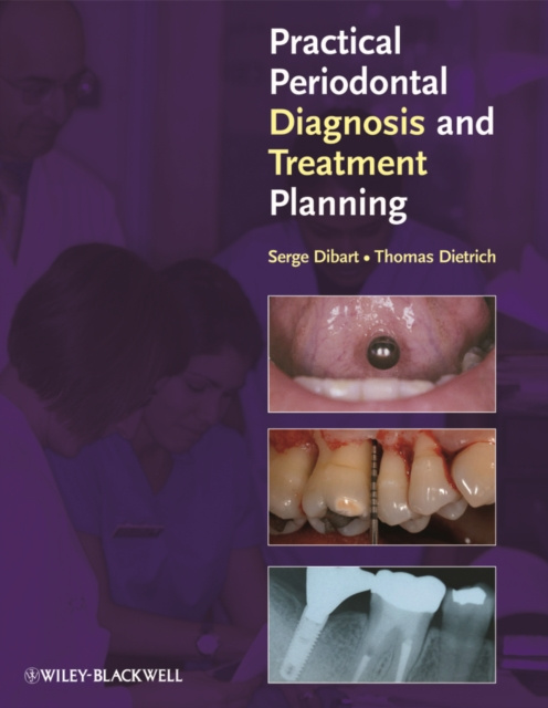 E-kniha Practical Periodontal Diagnosis and Treatment Planning Serge Dibart