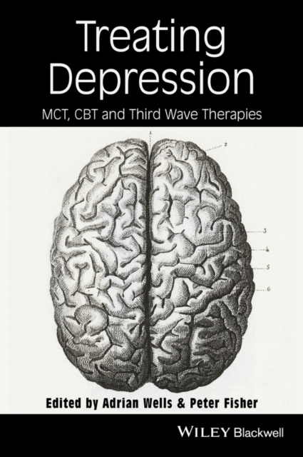 E-book Treating Depression Adrian Wells