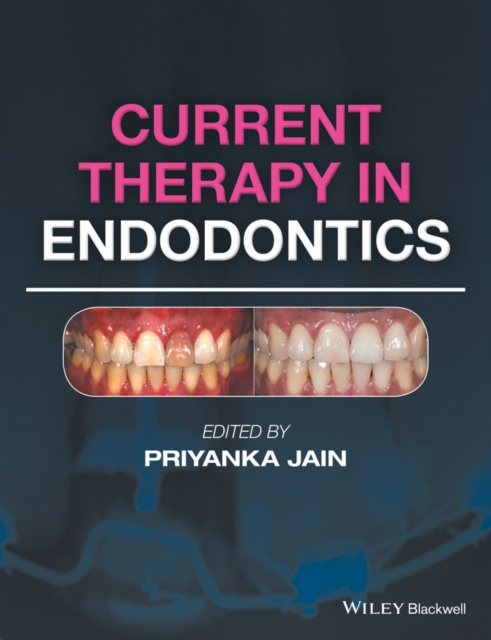 E-knjiga Current Therapy in Endodontics Priyanka Jain
