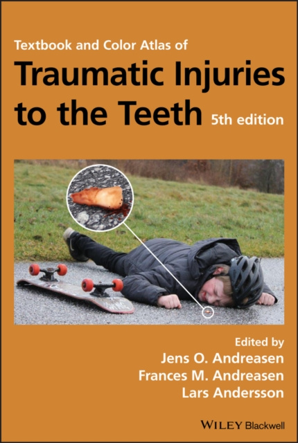 E-kniha Textbook and Color Atlas of Traumatic Injuries to the Teeth Jens O. Andreasen