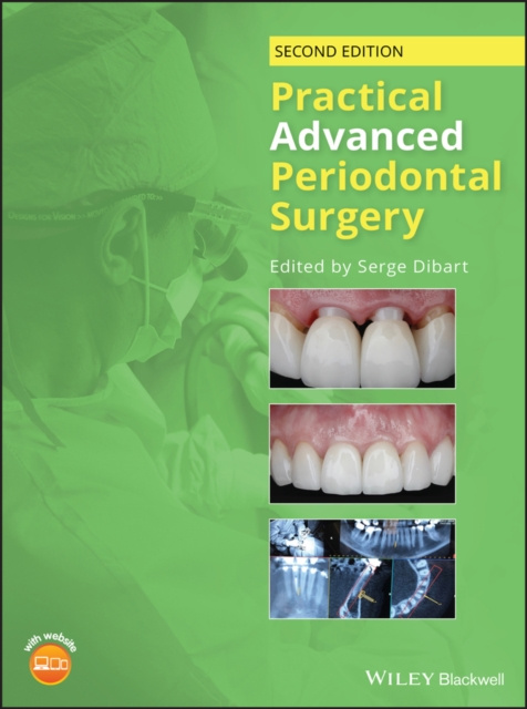 E-kniha Practical Advanced Periodontal Surgery Serge Dibart