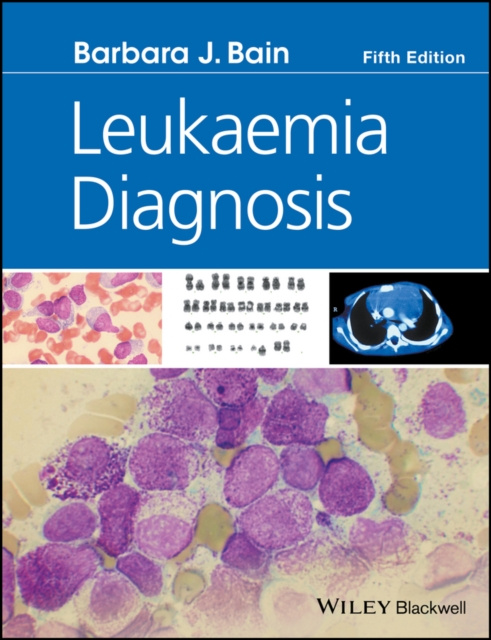 E-kniha Leukaemia Diagnosis Barbara J. Bain