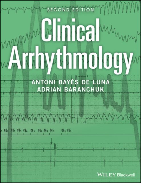 E-book Clinical Arrhythmology Antoni Bay&eacute;s de Luna