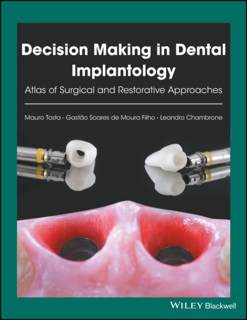 E-knjiga Decision Making in Dental Implantology Gast&atilde;o Soares de Moura Filho