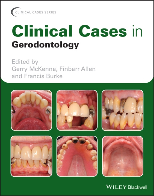 E-kniha Clinical Cases in Gerodontology Gerry McKenna