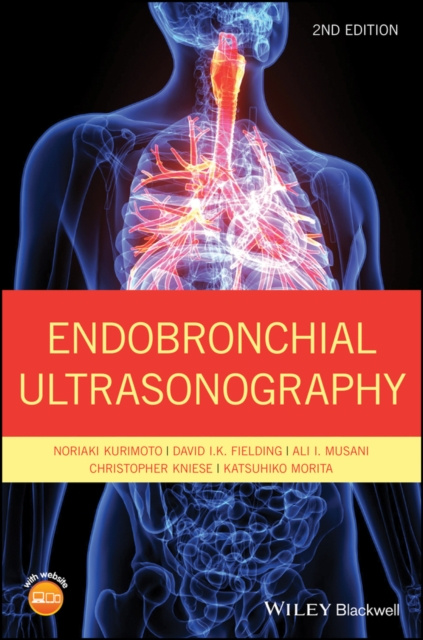 E-book Endobronchial Ultrasonography Noriaki Kurimoto