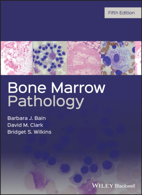 E-kniha Bone Marrow Pathology Barbara J. Bain