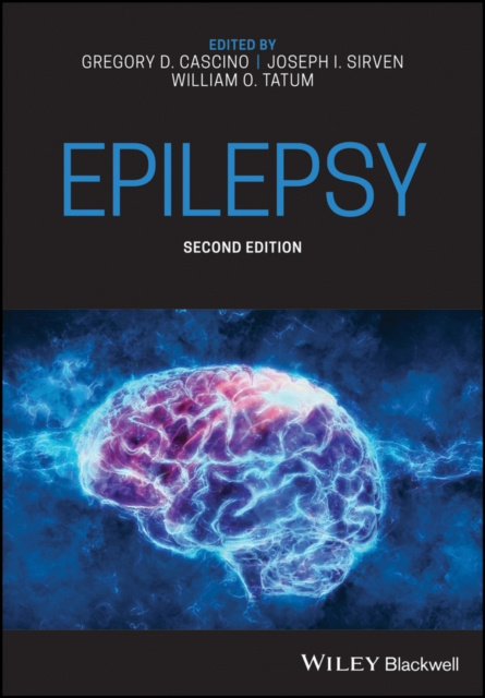 E-book Epilepsy Gregory D. Cascino