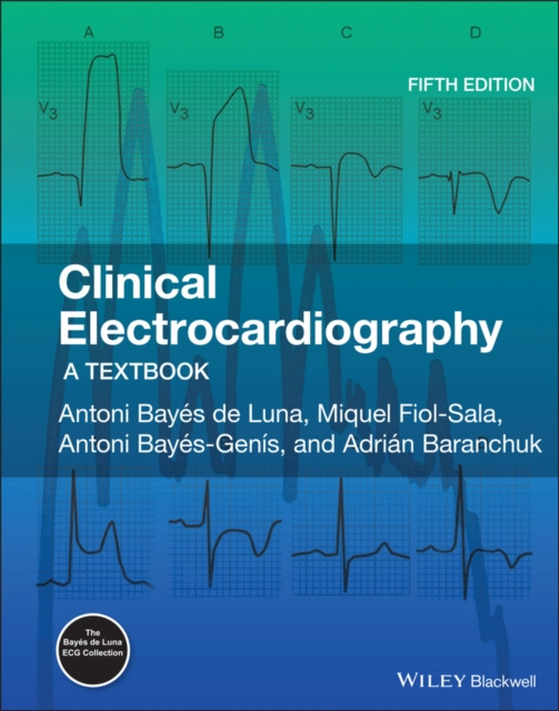E-knjiga Clinical Electrocardiography Antoni Bay&eacute;s de Luna
