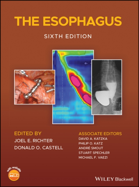 E-kniha Esophagus Donald O. Castell
