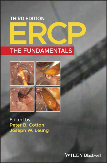 E-knjiga ERCP Peter B. Cotton