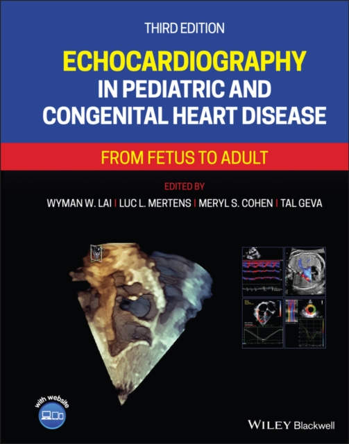 Libro elettronico Echocardiography in Pediatric and Congenital Heart Disease Wyman W. Lai