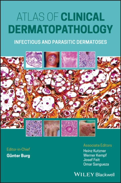 E-book Atlas of Clinical Dermatopathology G&uuml;nter Burg