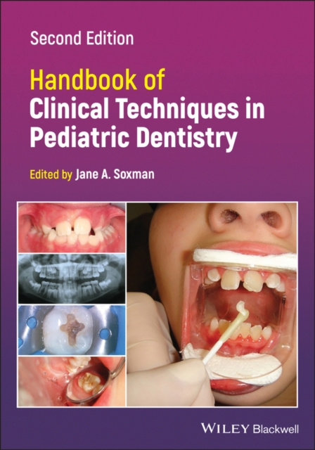 E-kniha Handbook of Clinical Techniques in Pediatric Dentistry Jane A. Soxman