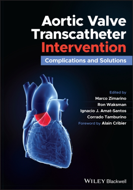 E-knjiga Aortic Valve Transcatheter Intervention Marco Zimarino