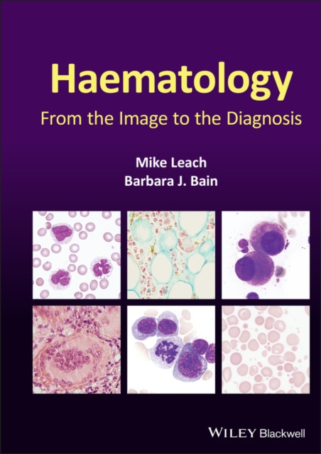 E-knjiga Haematology Mike Leach
