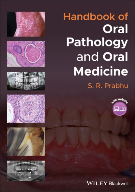 E-kniha Handbook of Oral Pathology and Oral Medicine S. R. Prabhu