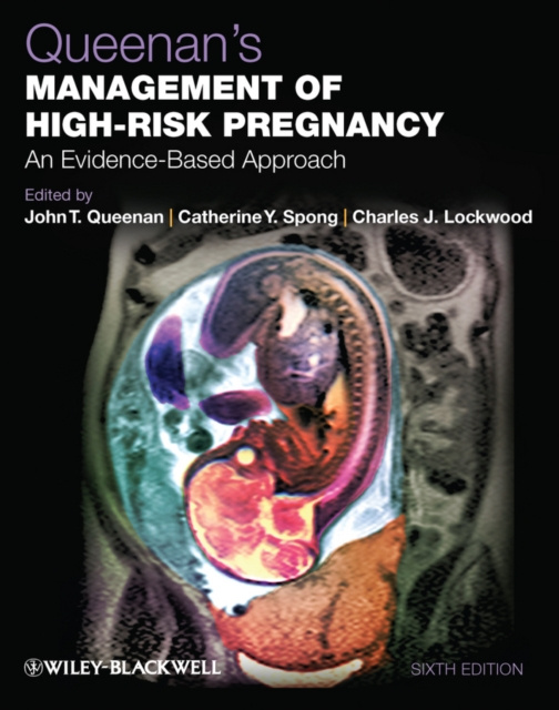 E-kniha Queenan's Management of High-Risk Pregnancy John T. Queenan