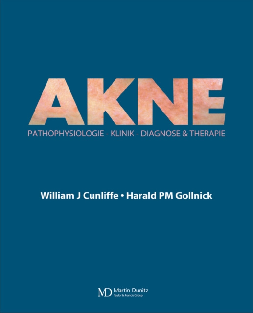 E-knjiga Acne William J Cunliffe