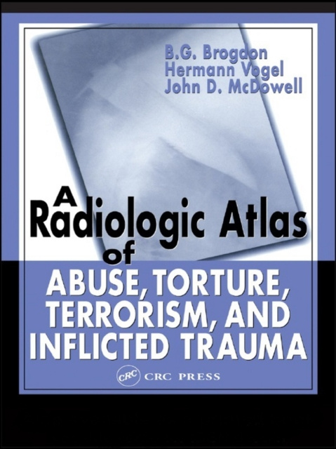E-kniha Radiologic Atlas of Abuse, Torture, Terrorism, and Inflicted Trauma B. G. Brogdon