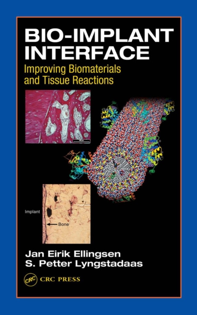 E-book Bio-Implant Interface J.E. Ellingsen