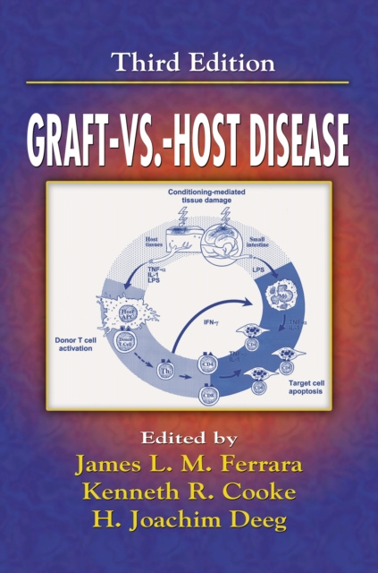 E-book Graft vs. Host Disease James Ferrara