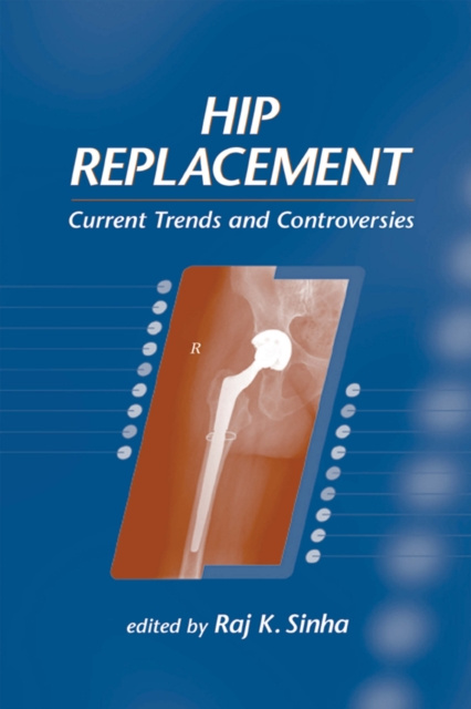 E-knjiga Hip Replacement Raj K. Sinha