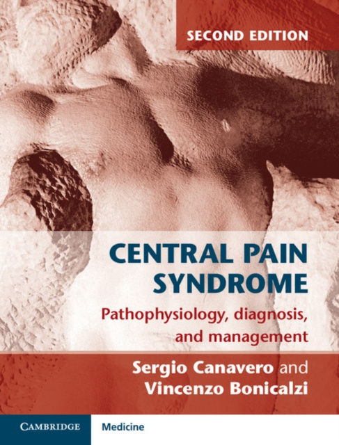 E-kniha Central Pain Syndrome Sergio Canavero