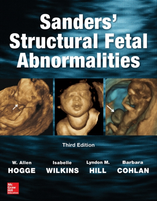 E-book Sanders' Structural Fetal Abnormalities, Third Edition W. Allen Hogge