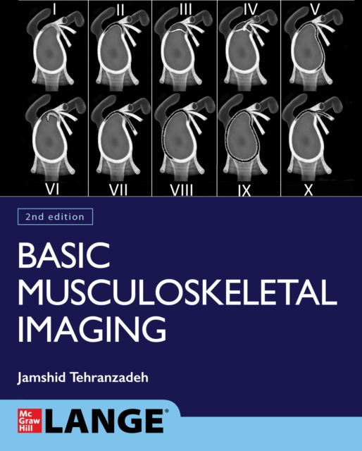 E-kniha Basic Musculoskeletal Imaging, Second Edition Jamshid Tehranzadeh