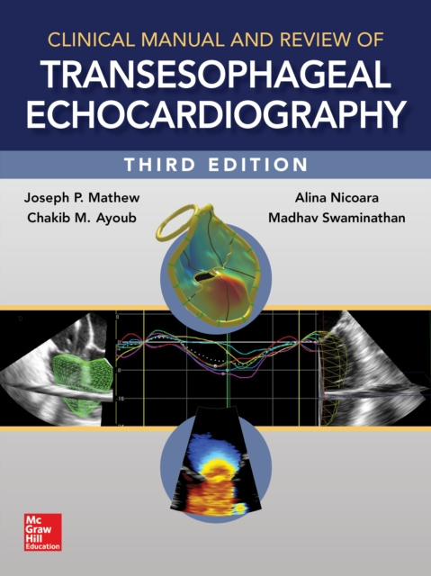 E-kniha Clinical Manual and Review of Transesophageal Echocardiography, 3/e Joseph Mathew
