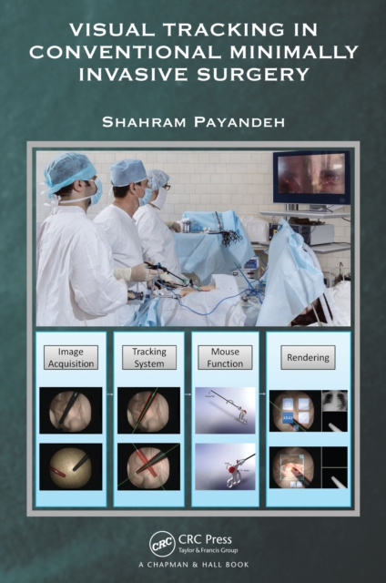 E-book Visual Tracking in Conventional Minimally Invasive Surgery Shahram Payandeh